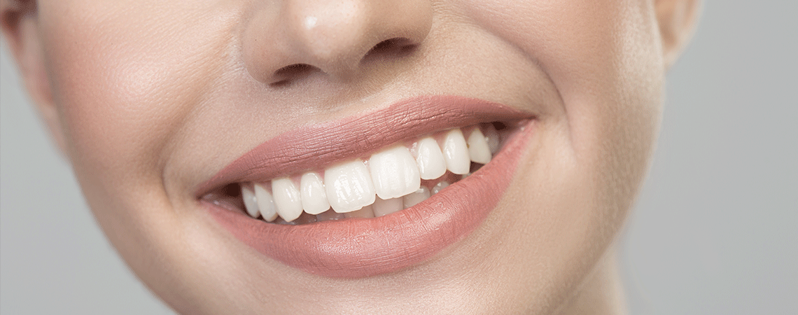 A close-up of a woman’s smile after orthodontic treatment