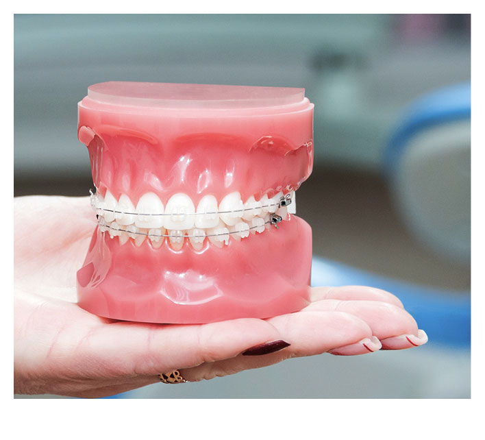 Why Patients Trust Just Braces